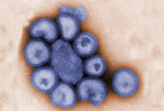 virus-grippe-h1n1
